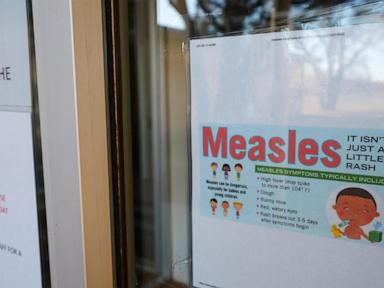 CDC studies show value of nationwide wastewater disease surveillance