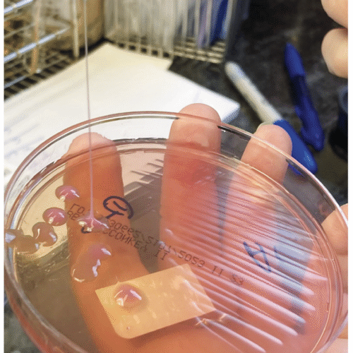 This may be the grossest eye pic ever—but the cause is what’s truly horrifying