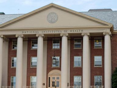Trump administration halts use of human fetal tissue in NIH-funded research