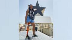 ‘My prosthetic leg represents my love for this country’