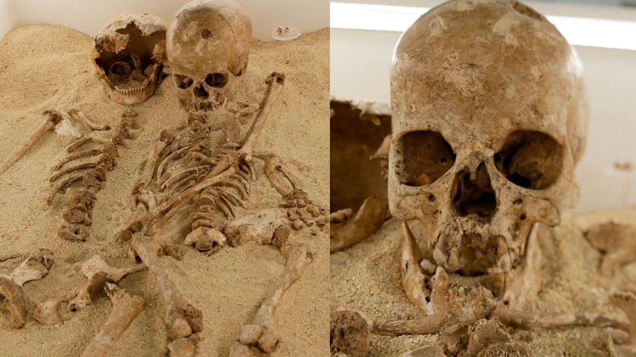 Teenage girl who lived in Italy 12,000 years ago had a rare form of dwarfism, DNA study shows