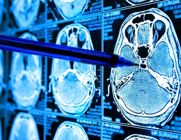 Neural circuits in flies provide insights into human eating