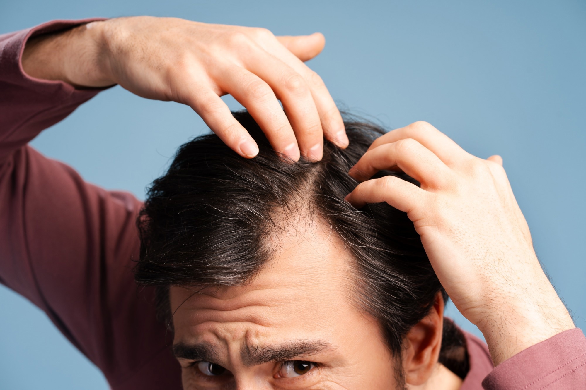 Which hair loss supplements actually work?