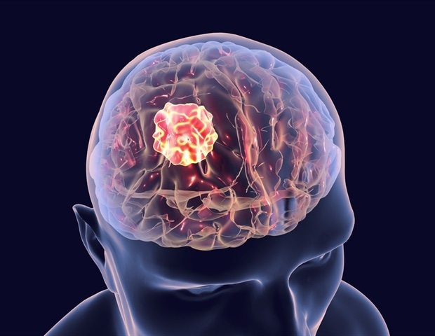 Small molecule targets glioblastoma oncogene in preclinical studies