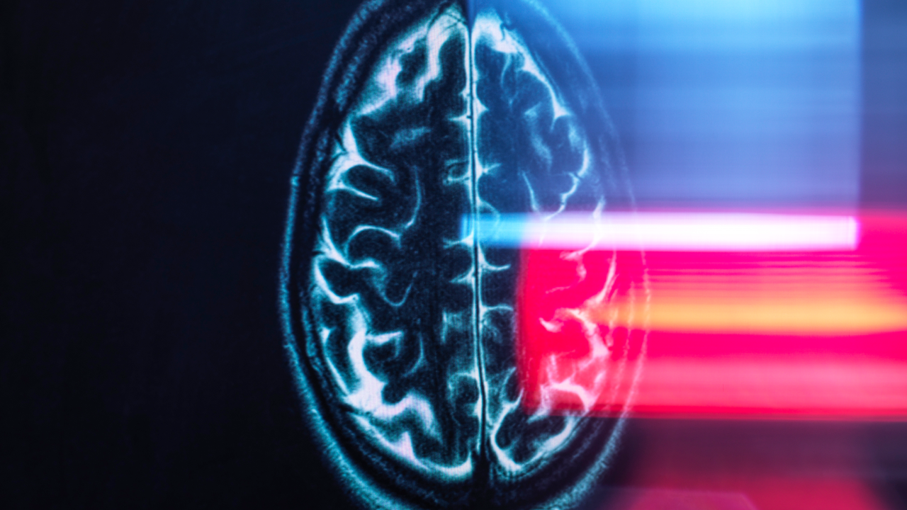 ‘The brain consistently moved upward and backward’: Astronauts’ brains physically shift in their heads during spaceflight