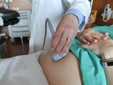 Early prenatal care, considered best for moms and babies, is on the decline in the US