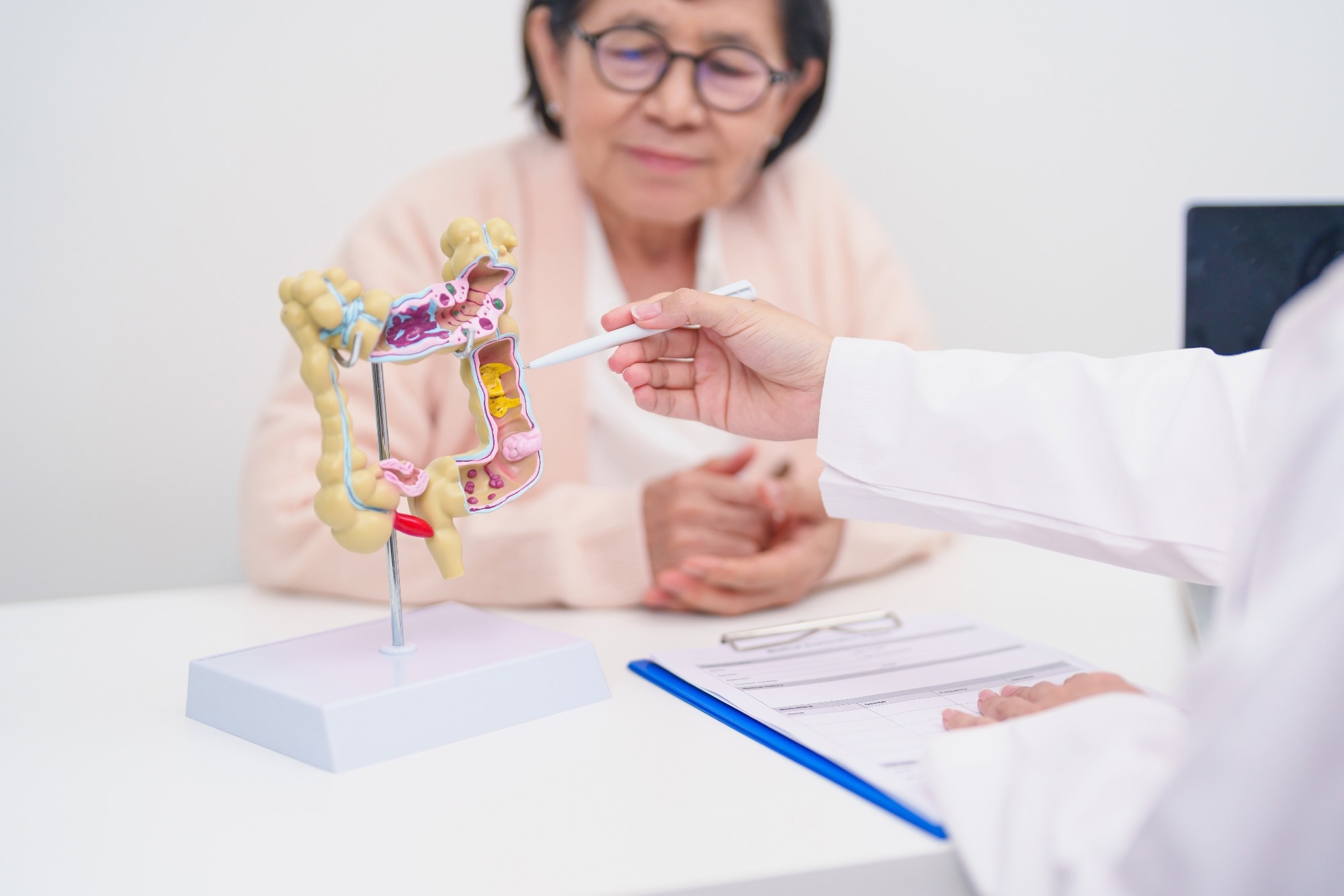 Colonoscopy and FIT at age 60 catch colorectal cancer earlier