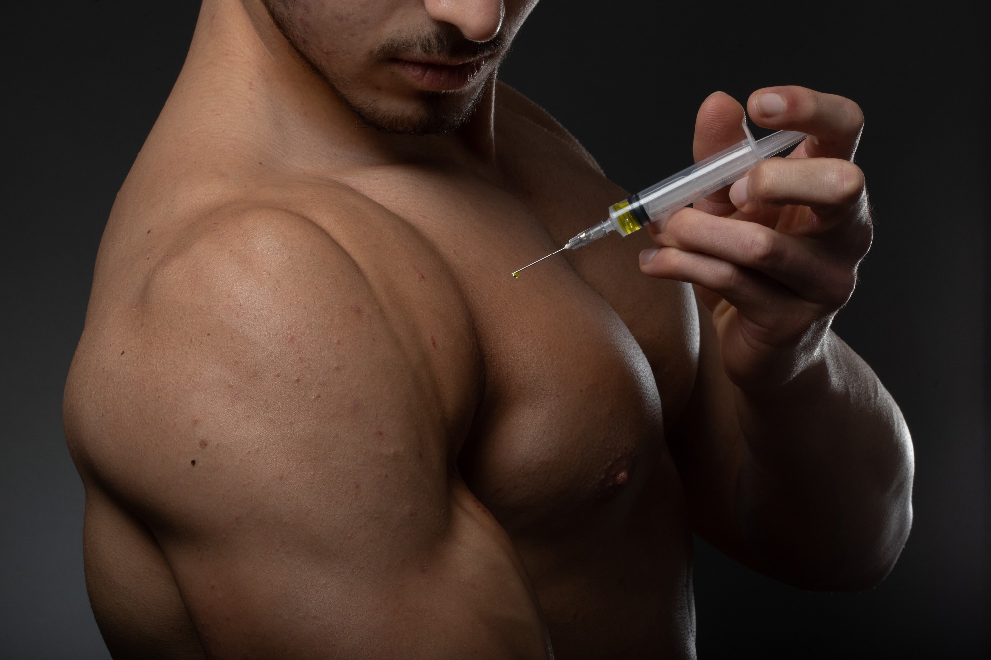 Social media muscle content raises steroid use intentions in young men