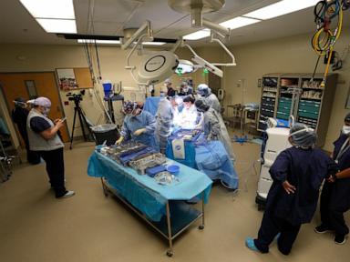 More organs are being donated after the heart stops, not brain death. Policies are changing too