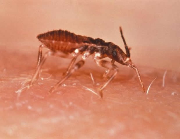 Researchers discover critical vulnerability shared by pathogens causing tropical diseases