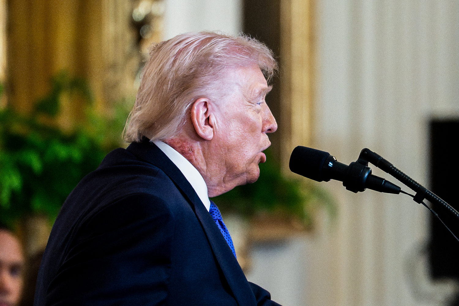 White House addresses ‘redness’ on the side of Trump’s neck