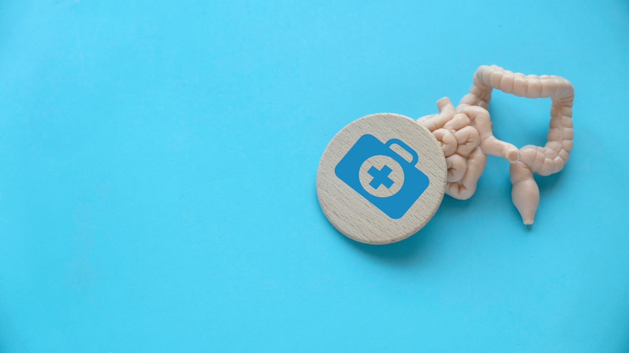 High-dose curcumin fails to produce lasting gut microbiome changes in IBD patients