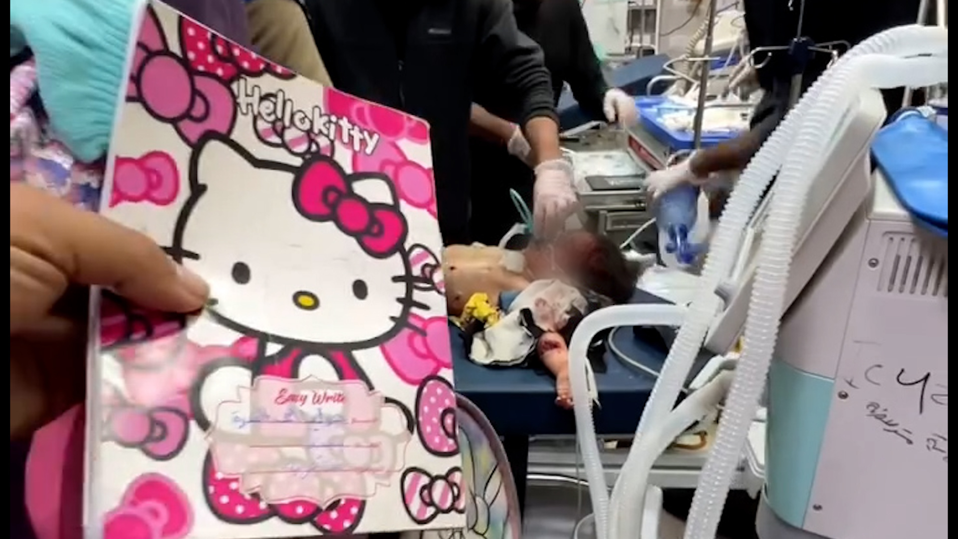 Doctors try to save girl as father was killed in Gaza Israeli attack