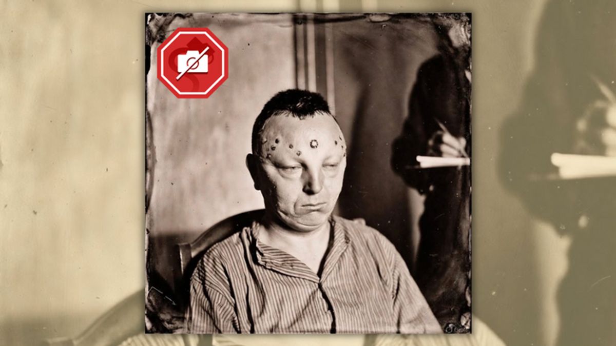 Watch out for claim photo shows James Peterson, man lobotomized for being gay in 1948