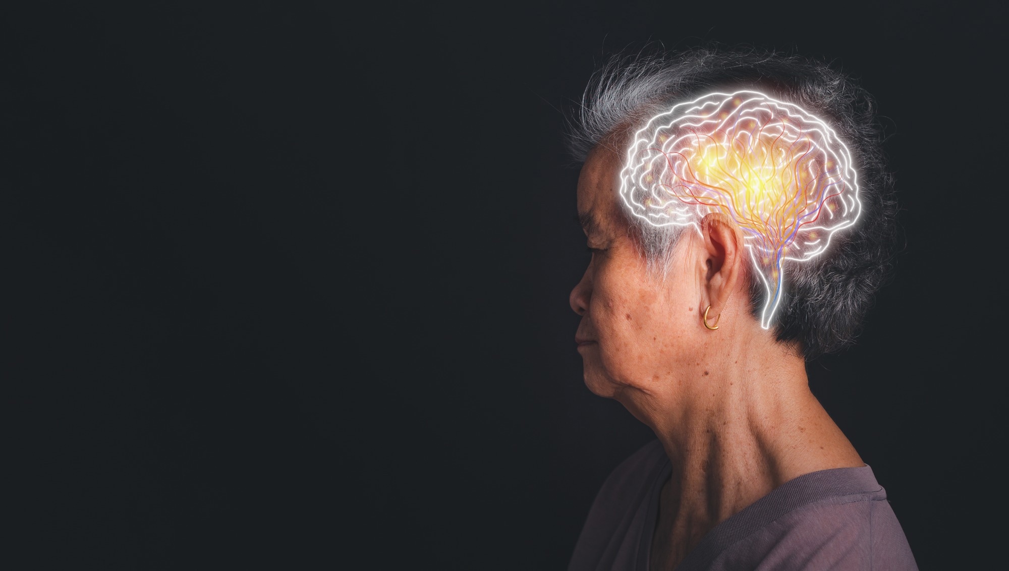 Blood test marker p-tau217 helps detect early dementia risk in cognitively healthy older women