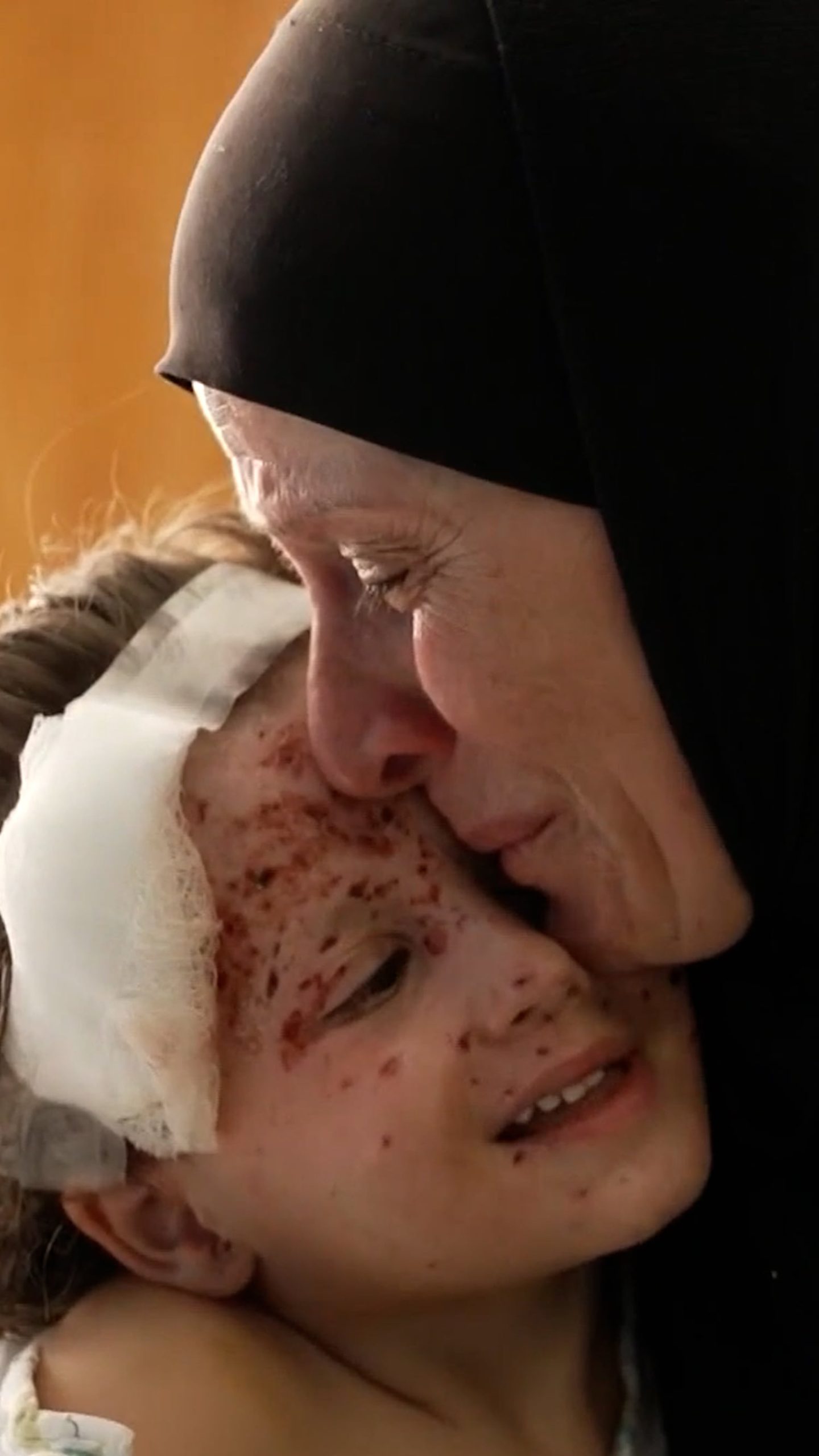 Inside a Beirut hospital treating wounded children