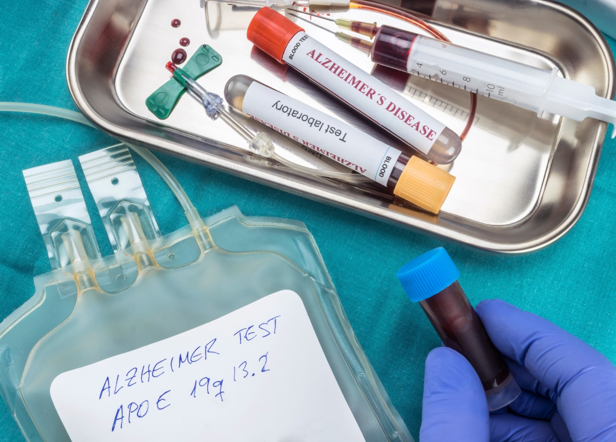 Blood protein structure changes may enable earlier detection of Alzheimer’s