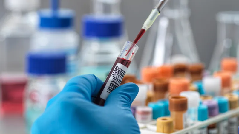 A newfound blood biomarker may one day predict longevity