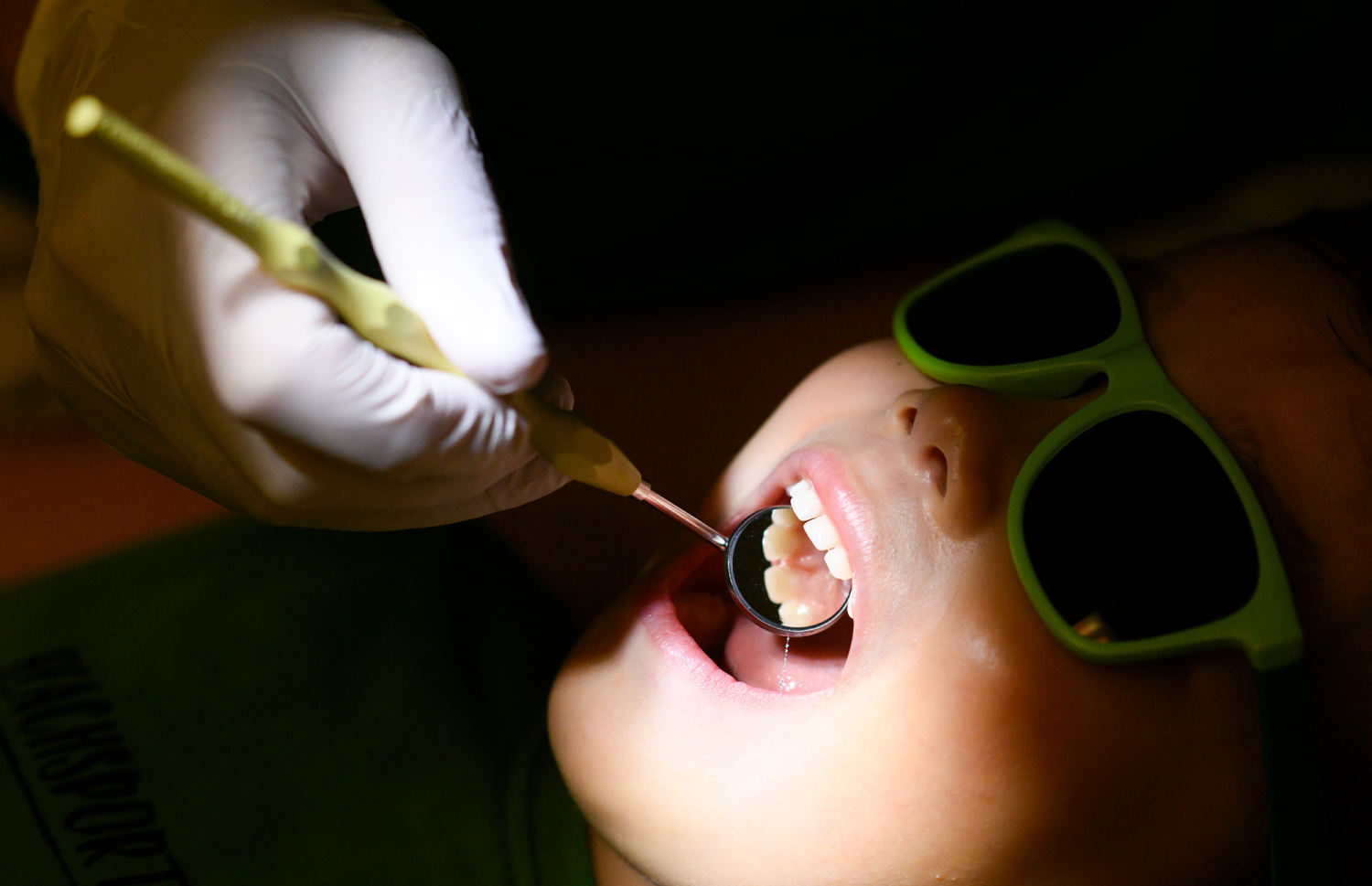If states ban fluoride, more kids will get cavities and Medicaid costs could soar, study finds