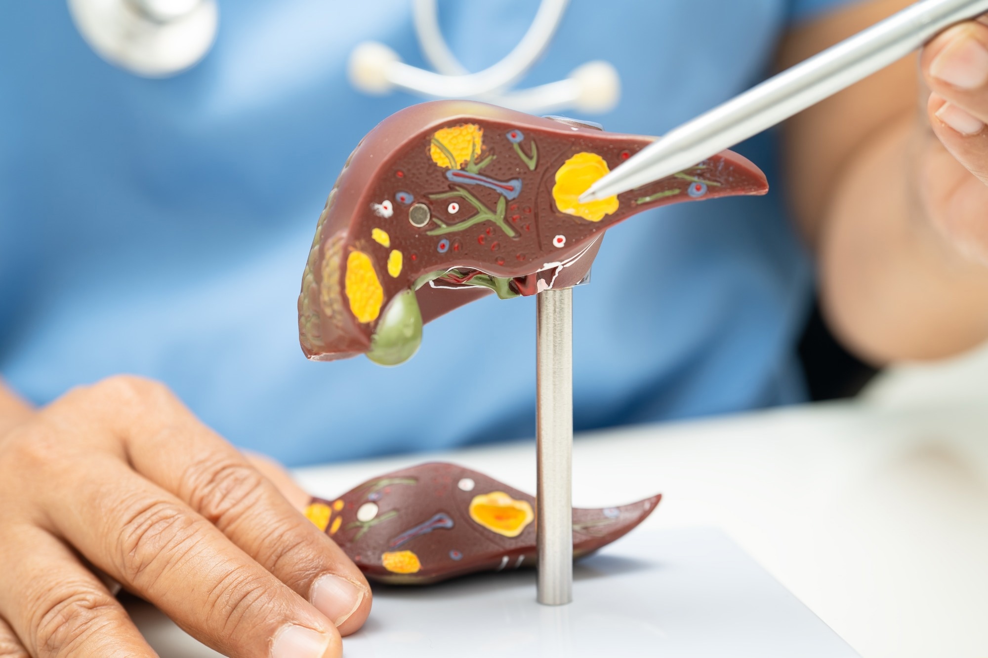 Palmatine improved fatty liver markers in a preclinical type 2 diabetes study