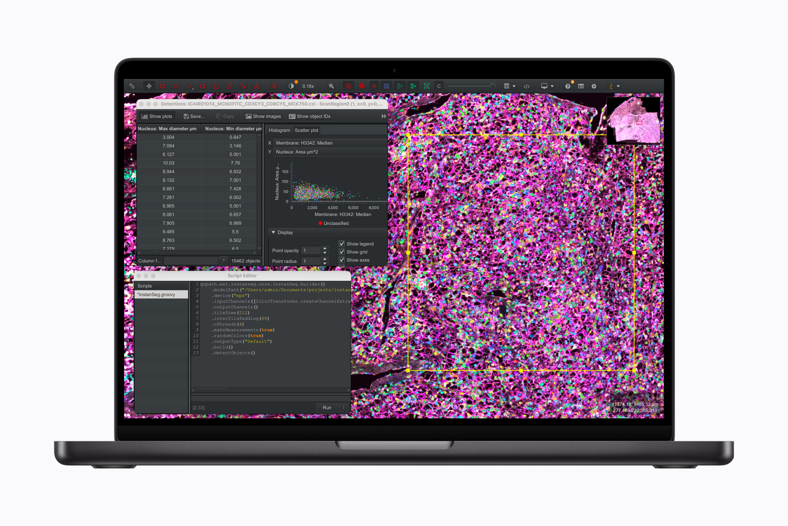 Apple’s AI endgame: Why waiting for Siri could make it a winner