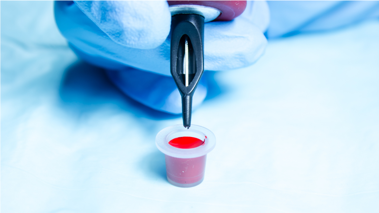 Diagnostic dilemma: A cross tattoo on a man’s neck disappeared — killing his skin as it did so