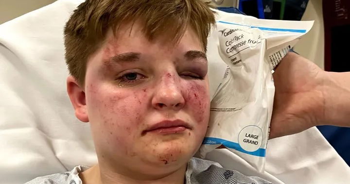 Remember when a lesbian teen was brutally beaten unconscious & robbed at McDonalds?