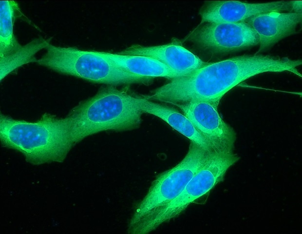 Terahertz radiation alters metabolism and signaling in melanoma cells