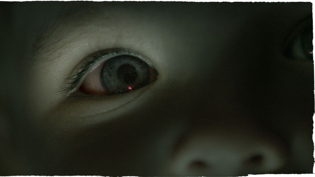 Pig semen component could deliver chemotherapy to hard-to-reach eye cancer, mouse study suggests