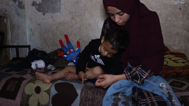 Gaza family says toddler released from Israeli custody found with cigarette burn marks