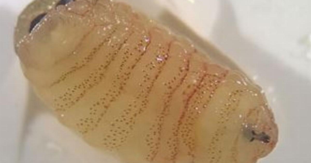 Woman starts sneezing out bugs after developing an infection