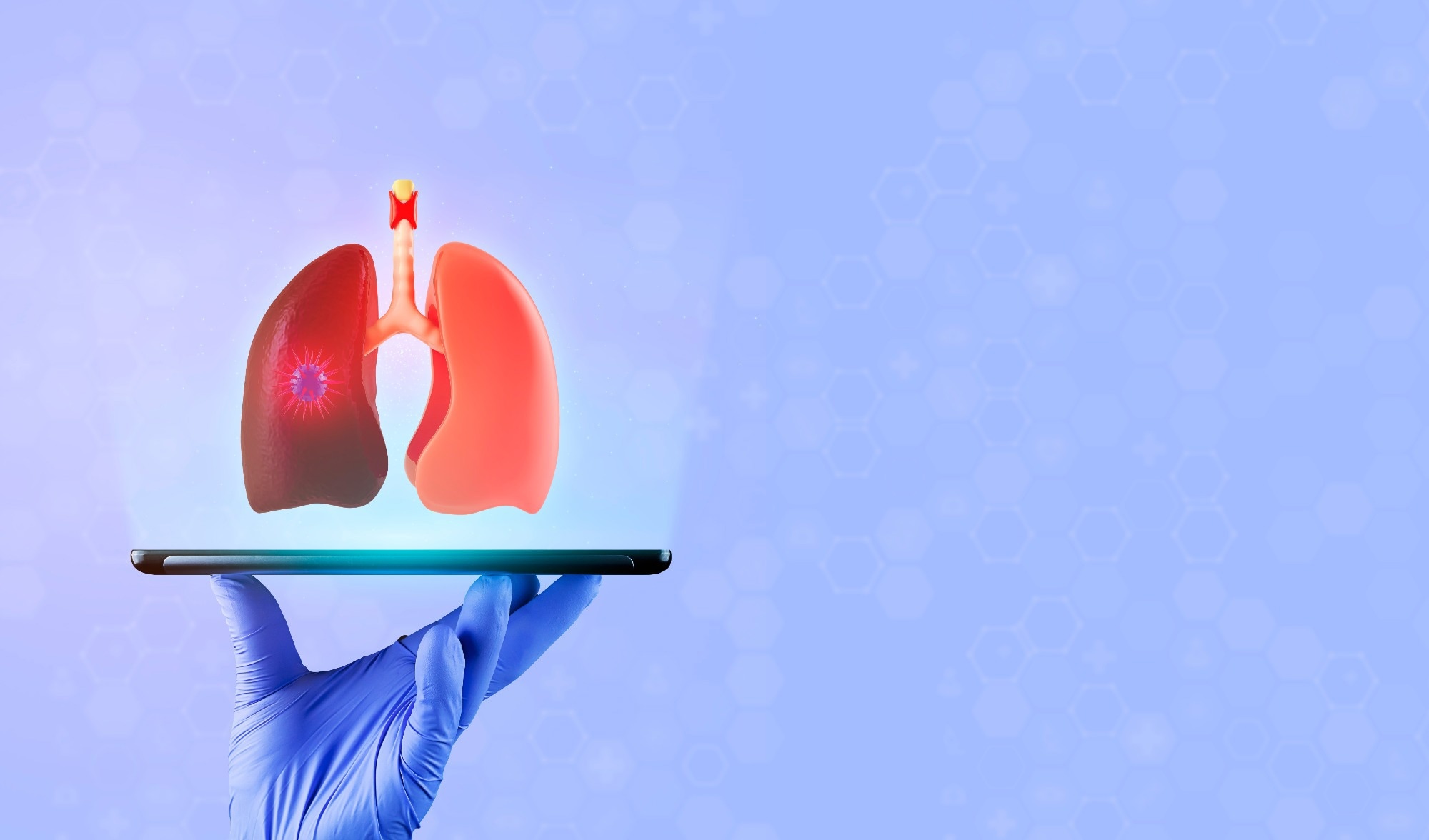 Lab study shows cigarette smoke damaged lung cells more than e-cigarette vapor