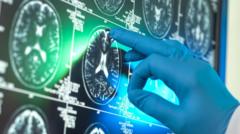 Breakthrough £90,000 Alzheimer’s drugs unlikely to benefit patients, report suggests