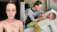 Hundreds contact BBC about mystery skin condition ‘hell’ – but doctors can’t agree it exists