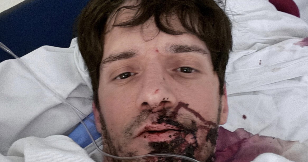 Gay adult performer Ty Roderick stabbed in “brutal” & “terrifying” attack