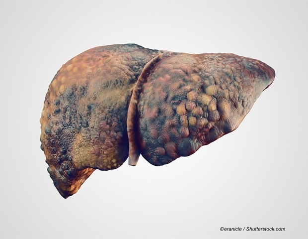 AGA update calls for better surveillance of hepatocellular carcinoma