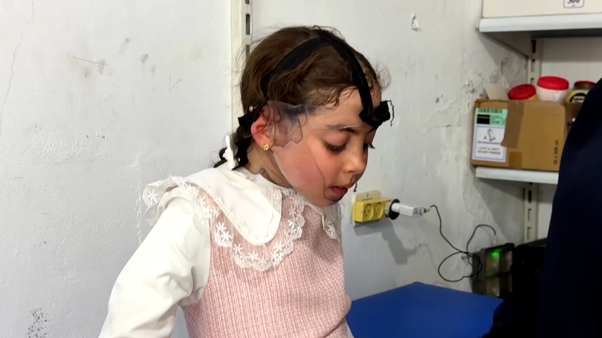 Burn treatment for Gaza children threatened by Israeli restrictions