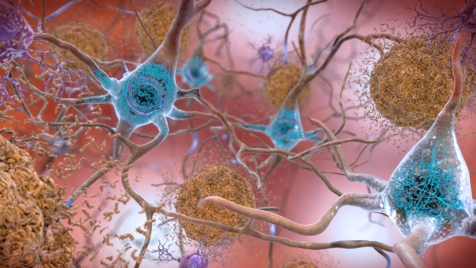 New Review Casts Doubt On Alzheimers Drugs But Is Controversial