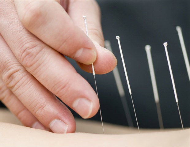 Acupuncture regulates immune function through specific neural circuit activation