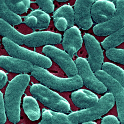 Flesh-eating bacteria devour man’s arm and leg in just three days