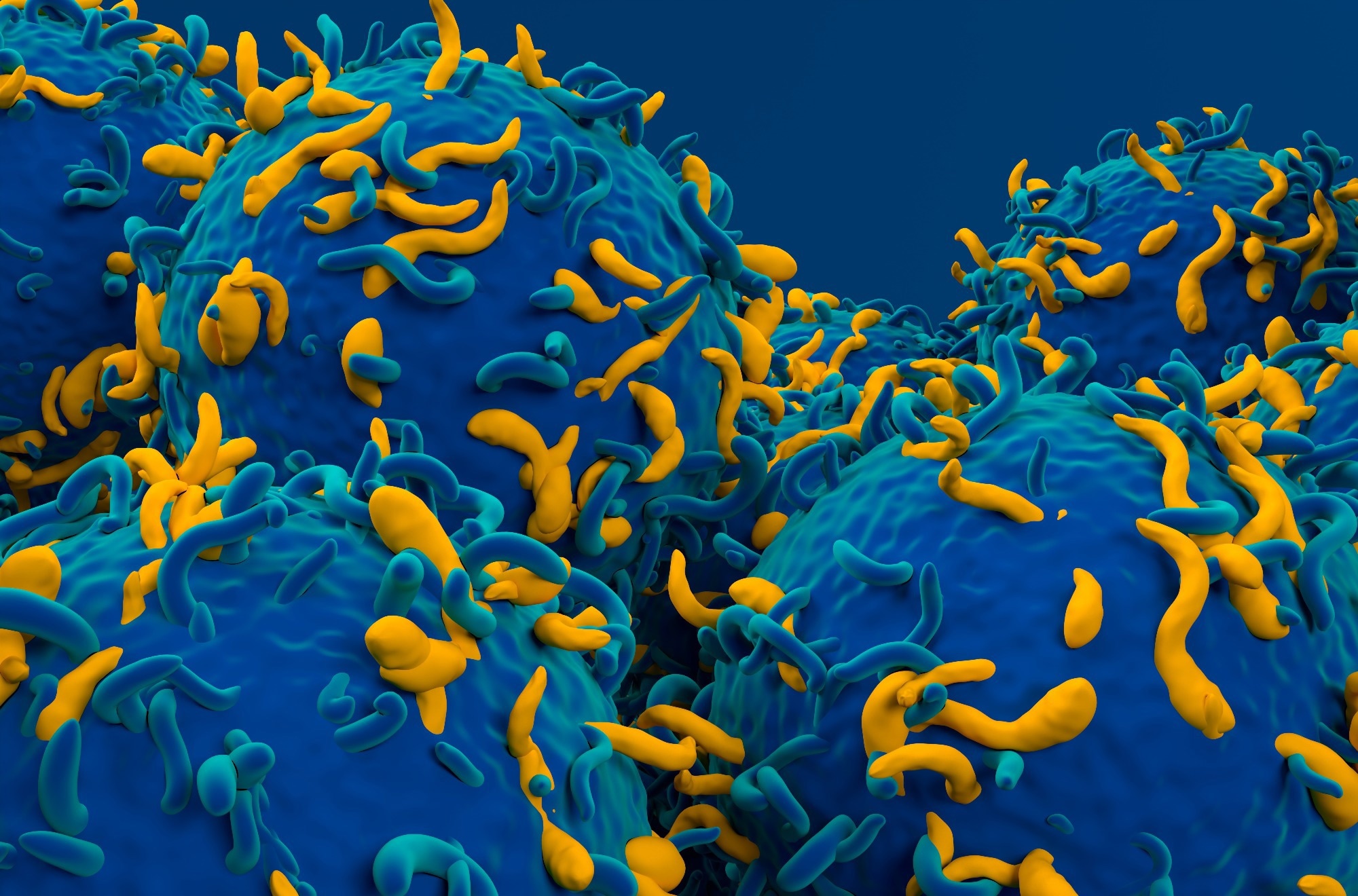 Scientists redesign CAR-T cells to fight more than cancer