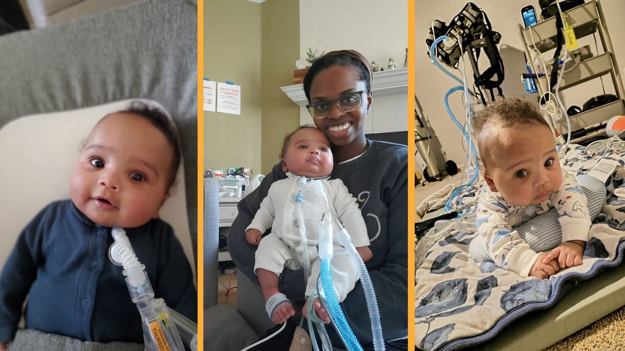 ‘Two lives hang in the balance’: Risky surgery in the womb saved baby from deadly disorder at just 25 weeks gestation