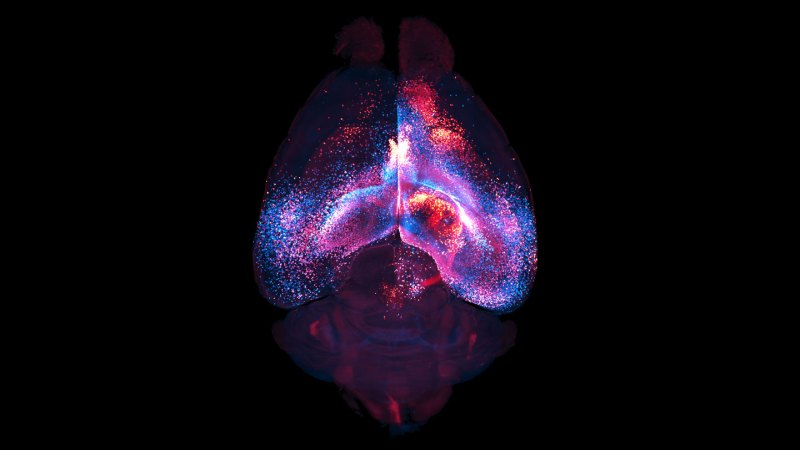 Newly mapped brain networks link far-flung regions