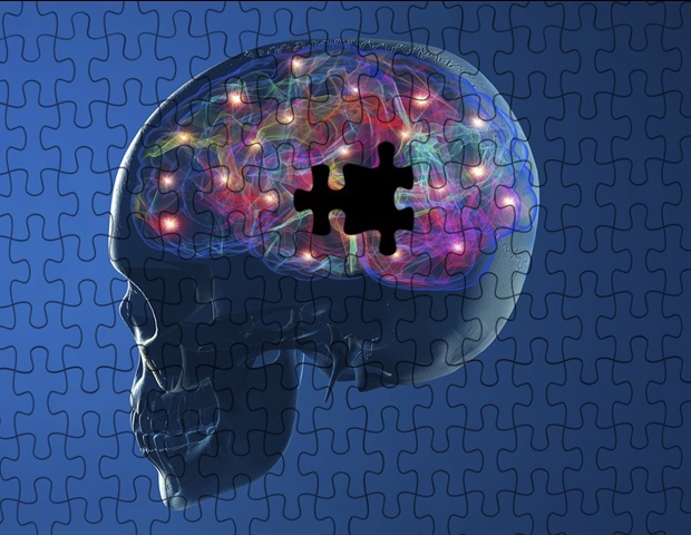New molecular framework paves the way for targeted Parkinson’s therapeutic interventions