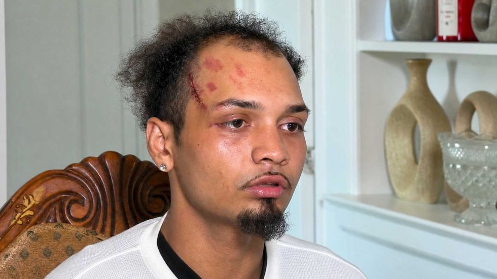 ‘They wanted to kill me’: New York man speaks out after ICE mistakenly beats him