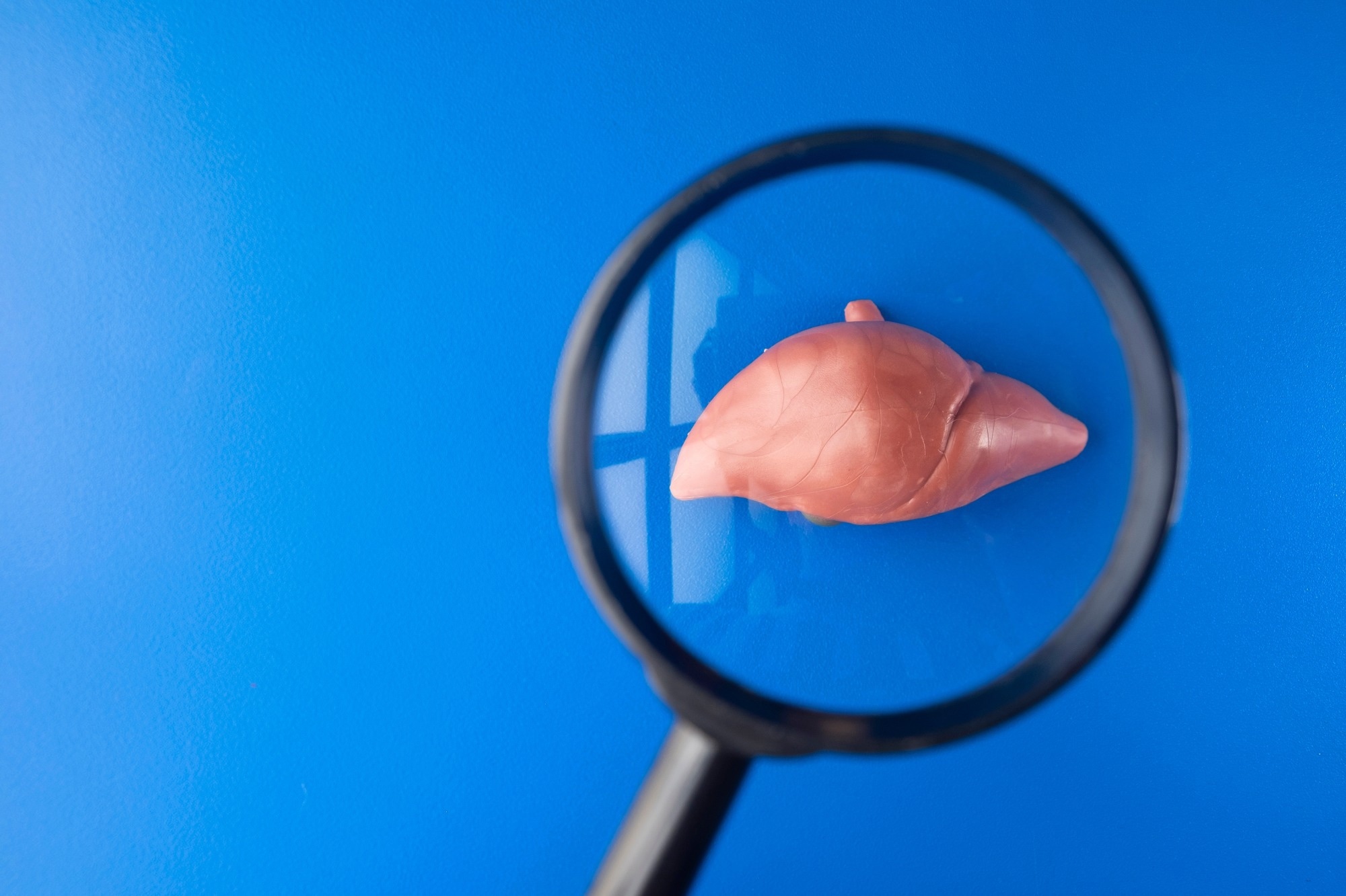 Liver fat may disrupt post-meal glucagon control in early type 2 diabetes