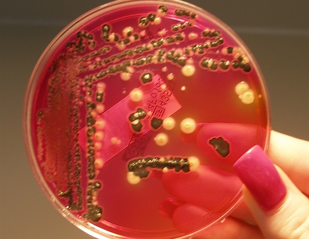 Intestinal stem cells identified as active defenders against Salmonella infection