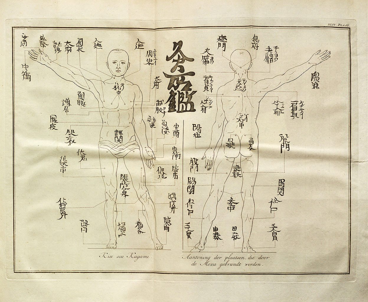 NYT Epic Fail on Acupuncture