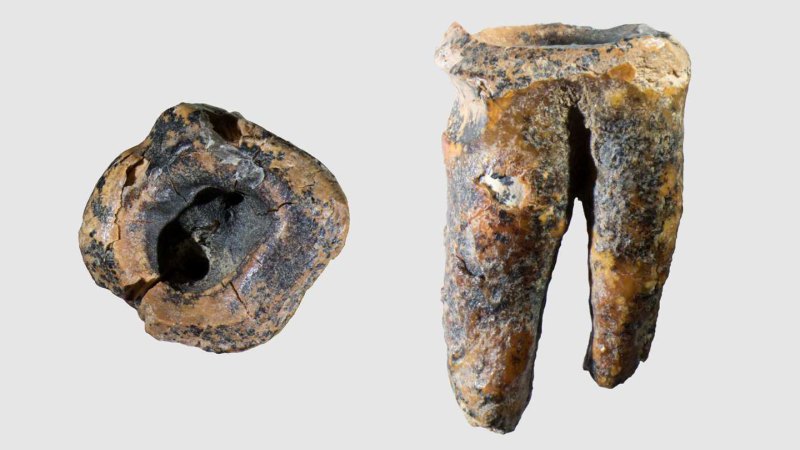 First evidence of Neandertal dentistry found in ancient molar