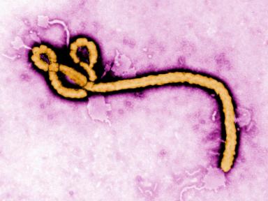 A look at major Ebola outbreaks and when the disease was first identified